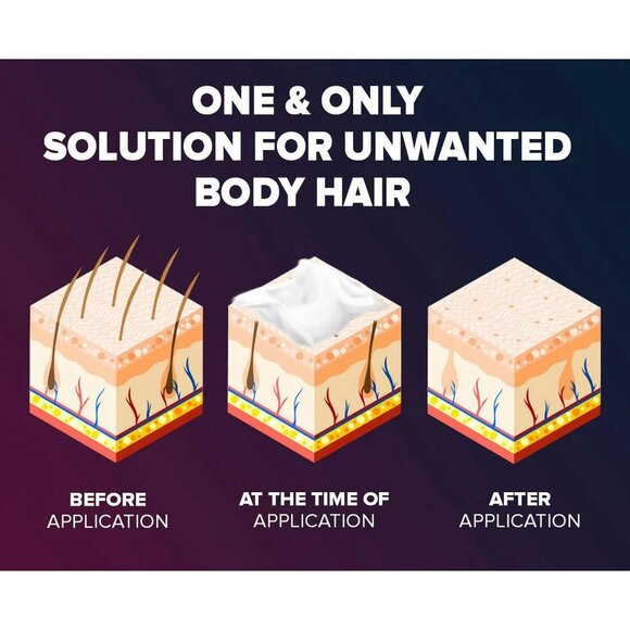 EPIFY - Picture 10 of 15